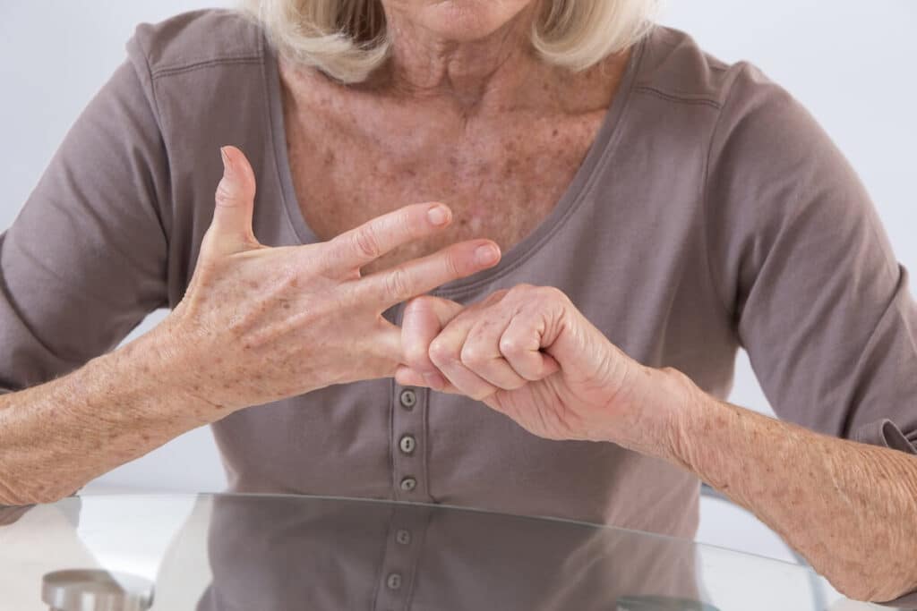 Older woman stretching her hand due to arthritis